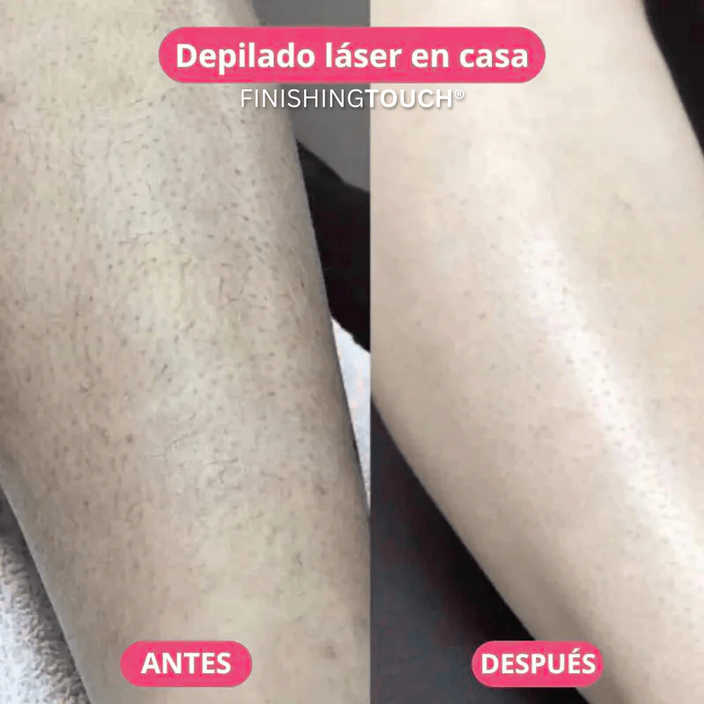 Orbia™ | DEPILADORA LÁSER CORPORAL